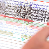 Auswerung der Polysomnographie 