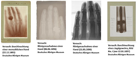 Diese Röntgenbilder gehören jetzt zum UNESCO-Weltdokumentenerbe.