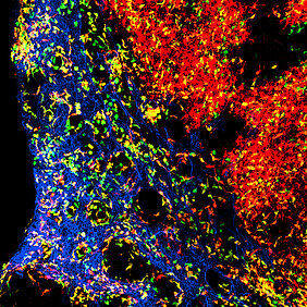 Die Abbildung zeigt die komplexe Organisation von dendritischen Zellen im Lymphknoten. Blau dargestellt sind Blutgefäße. Die grün dargestellten Zellen sind junge dendritische Zellen, wohingegen die rot dargestellten dendritischen Zellen ein paar Tage älter und bereits weitergewandert sind. Die orange dargestellten dendritischen Zellen liegen im Alter dazwischen. Die Abbildung zeigt die komplexe Organisation von dendritischen Zellen im Lymphknoten. Blau dargestellt sind Blutgefäße. Die grün dargestellten Zellen sind junge dendritische Zellen, wohingegen die rot dargestellten dendritischen Zellen ein paar Tage älter und bereits weitergewandert sind. Die orange dargestellten dendritischen Zellen liegen im Alter dazwischen.